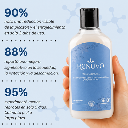 Shampoo RENUVO® Anti Seborrea y Psoriasis Capilar - Fórmula natural para Dermatitis Seborreica.